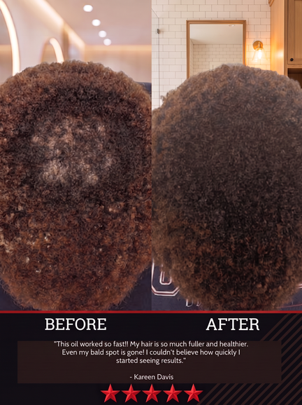 The All-Natural Hair Growth Solution by Black Widow® (Buy More & Save)