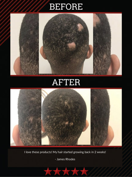The All-Natural Hair Growth Solution by Black Widow® (Buy More & Save)