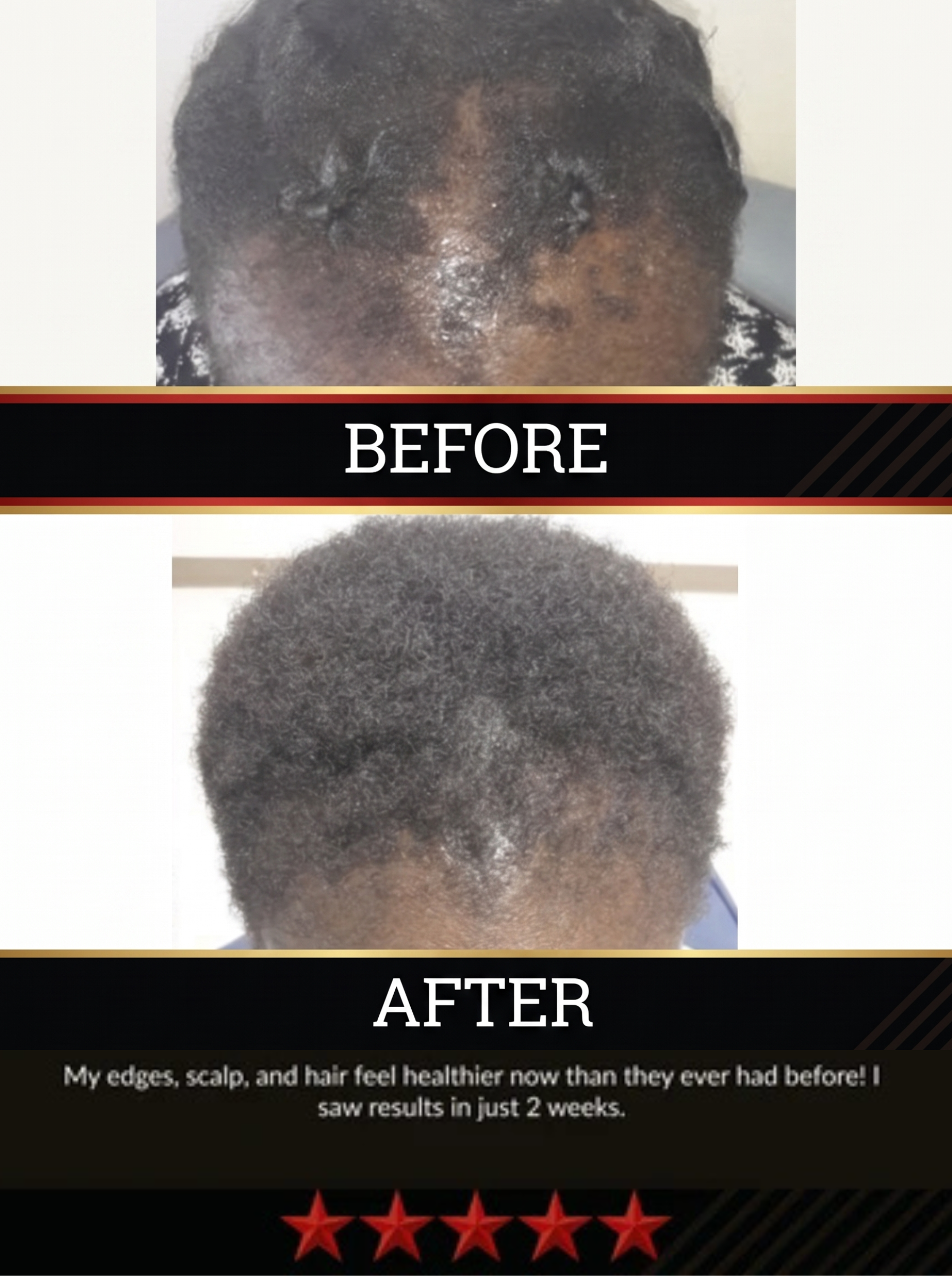 The All-Natural Hair Growth Solution by Black Widow® (Buy More & Save)
