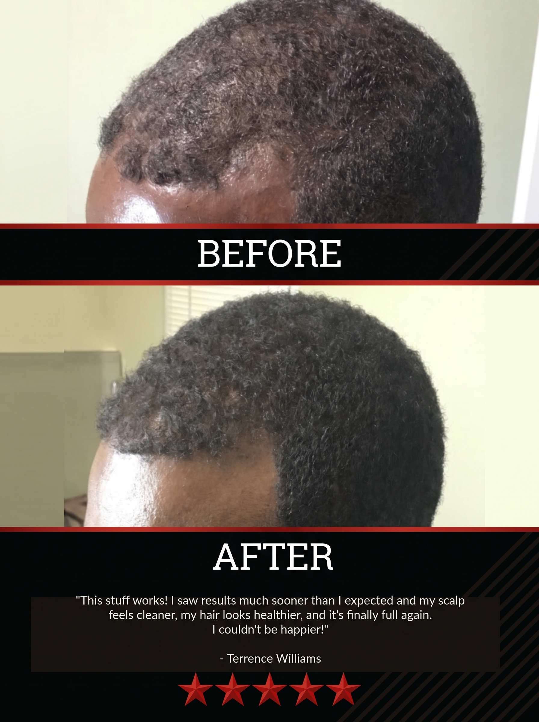 The All-Natural Hair Growth Solution by Black Widow® (Buy More & Save)
