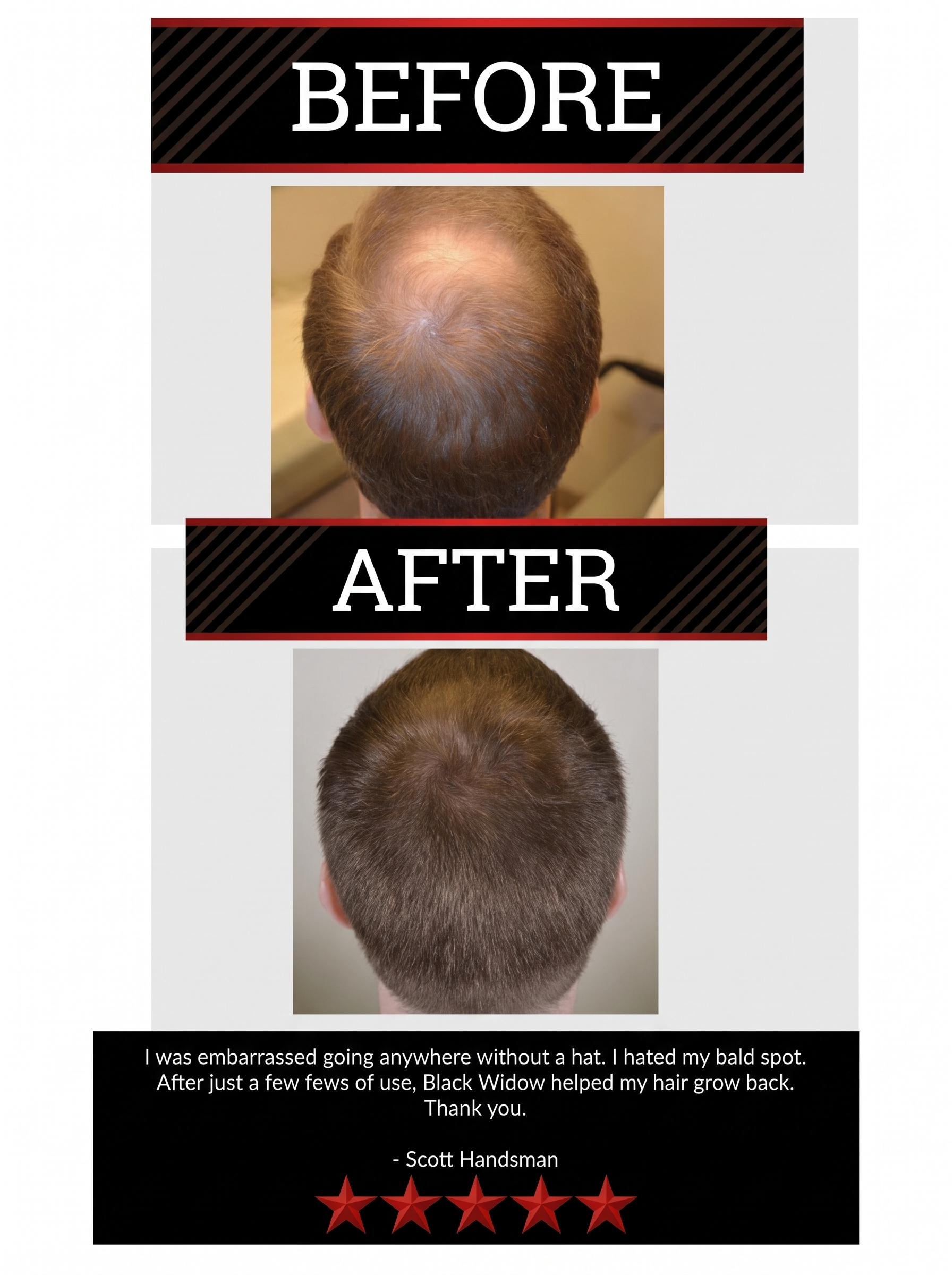 The All-Natural Hair Growth Solution by Black Widow® (Buy More & Save)