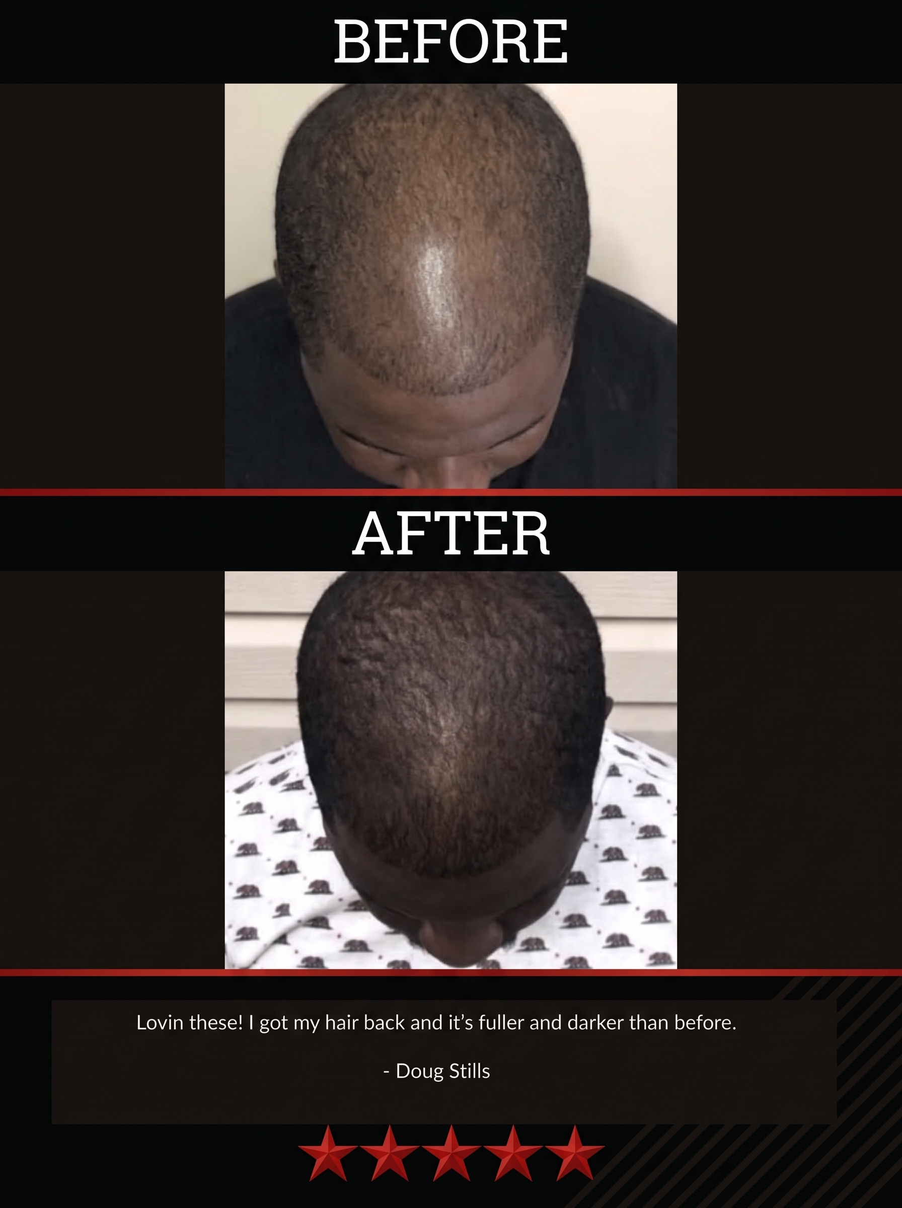 The All-Natural Hair Growth Solution by Black Widow® (Buy More & Save)