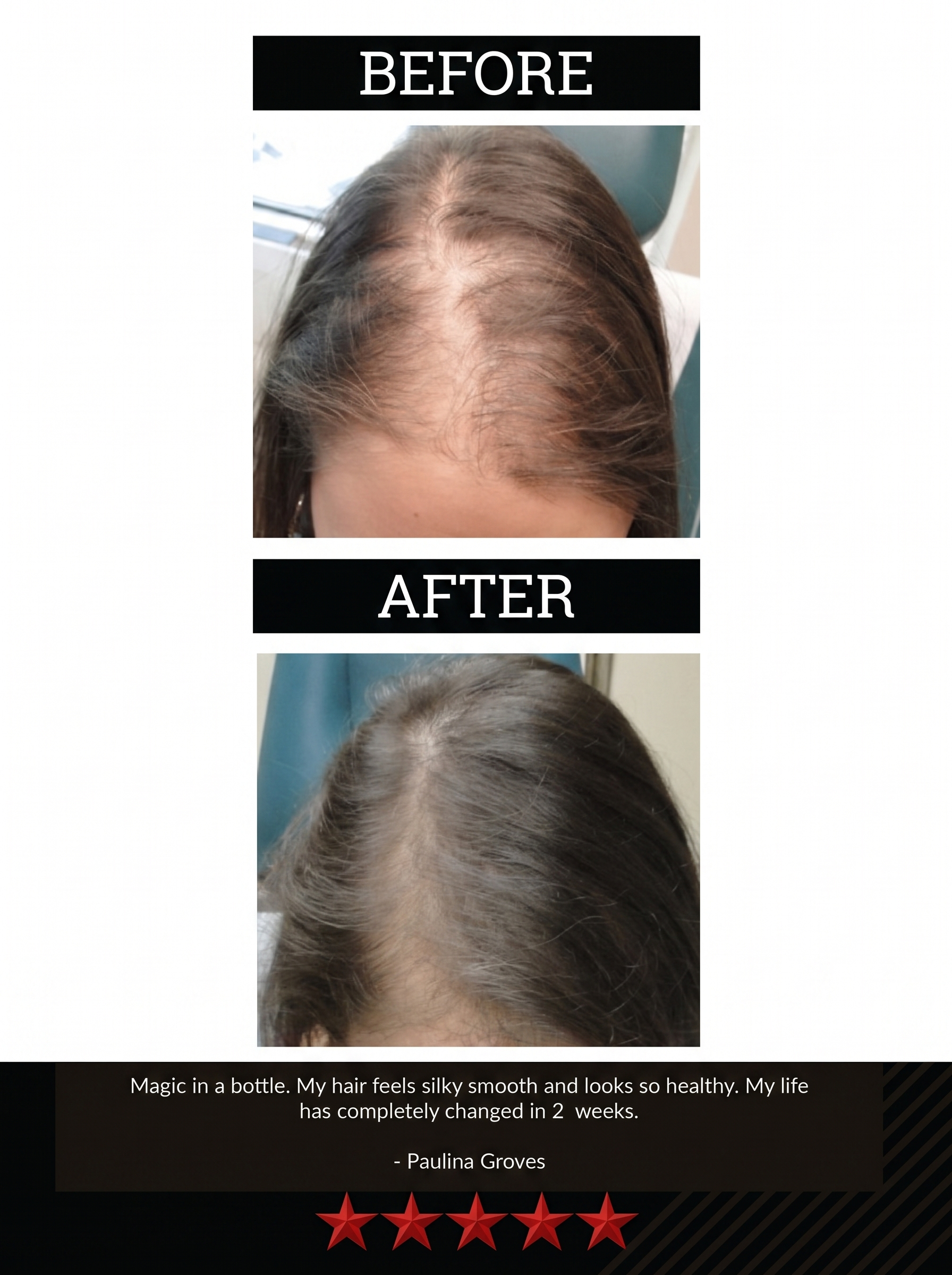 The All-Natural Hair Growth Solution by Black Widow® (Buy More & Save)