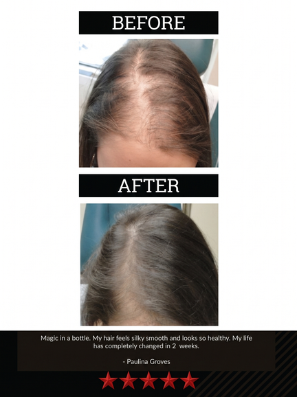 The All-Natural Hair Growth Solution by Black Widow® (Buy More & Save)