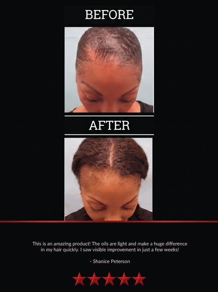 The All-Natural Hair Growth Solution by Black Widow® (Buy More & Save)