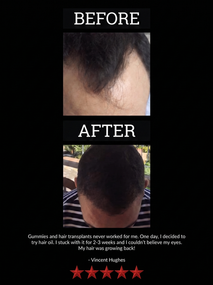 The All-Natural Hair Growth Solution by Black Widow® (Buy More & Save)