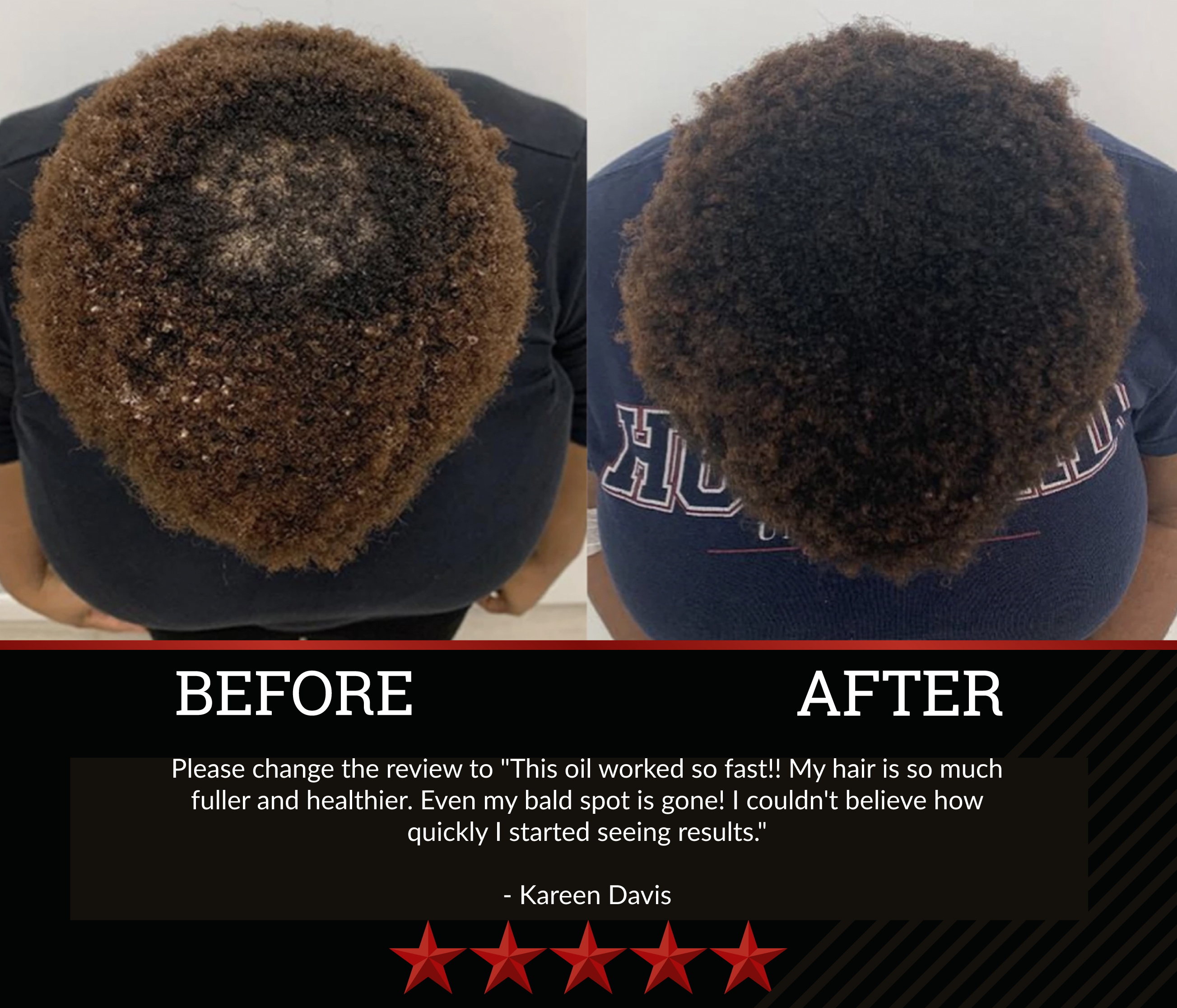 Black Widow Hair Growth Oil (2 Bottles)