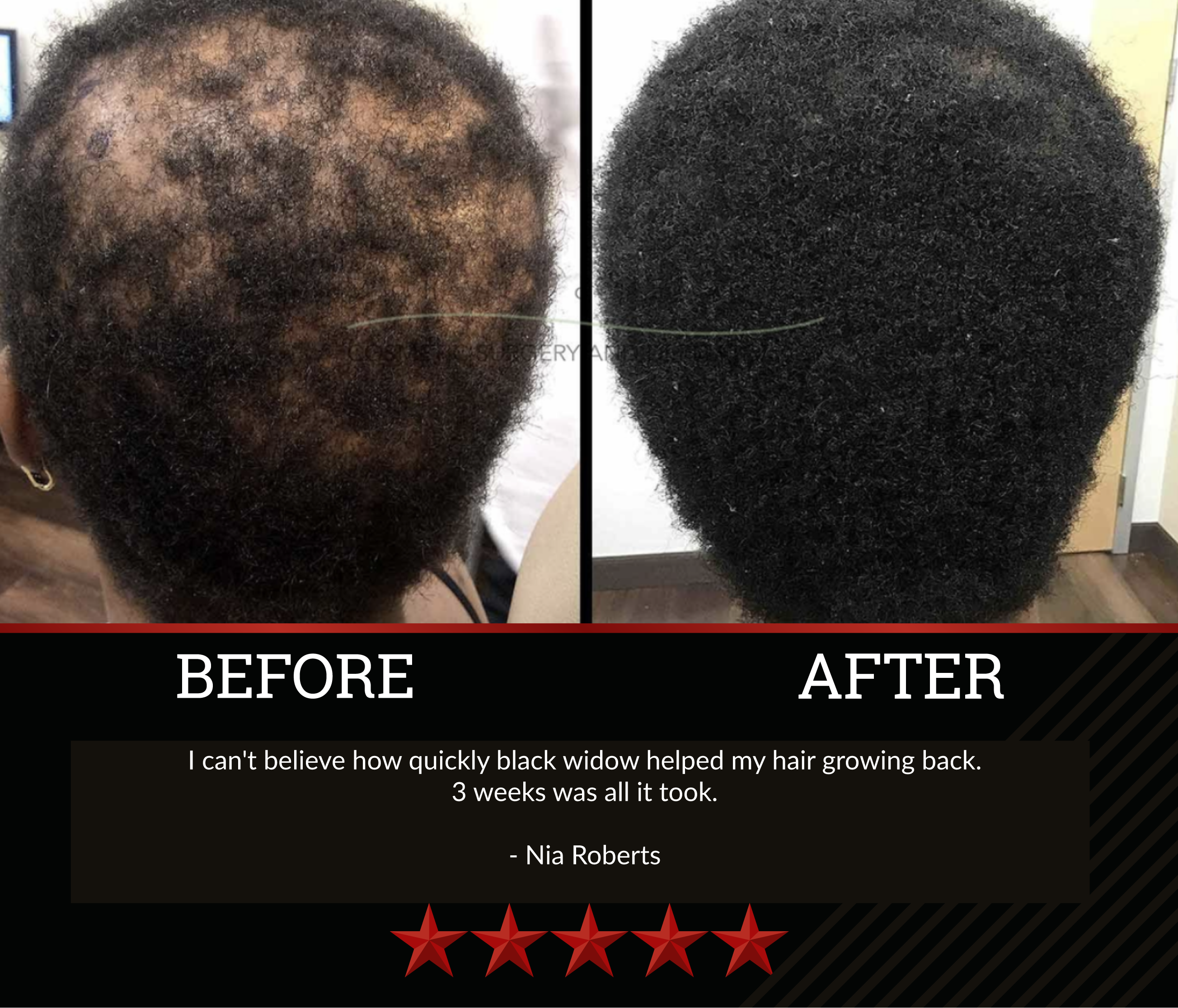Black Widow Hair Growth Oil (3 Bottles)