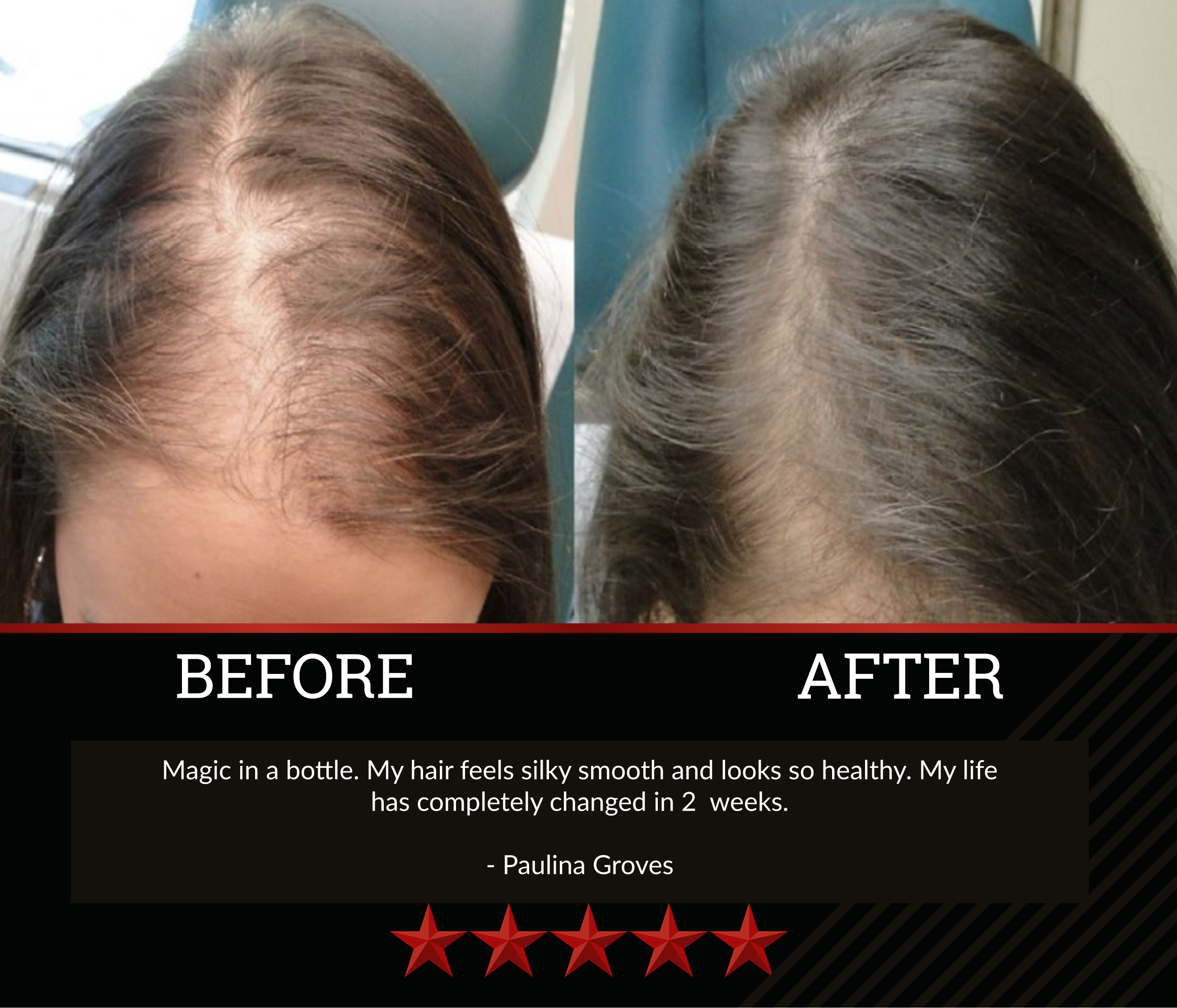 The All-Natural Hair Growth Solution by Black Widow® (Buy More & Save)