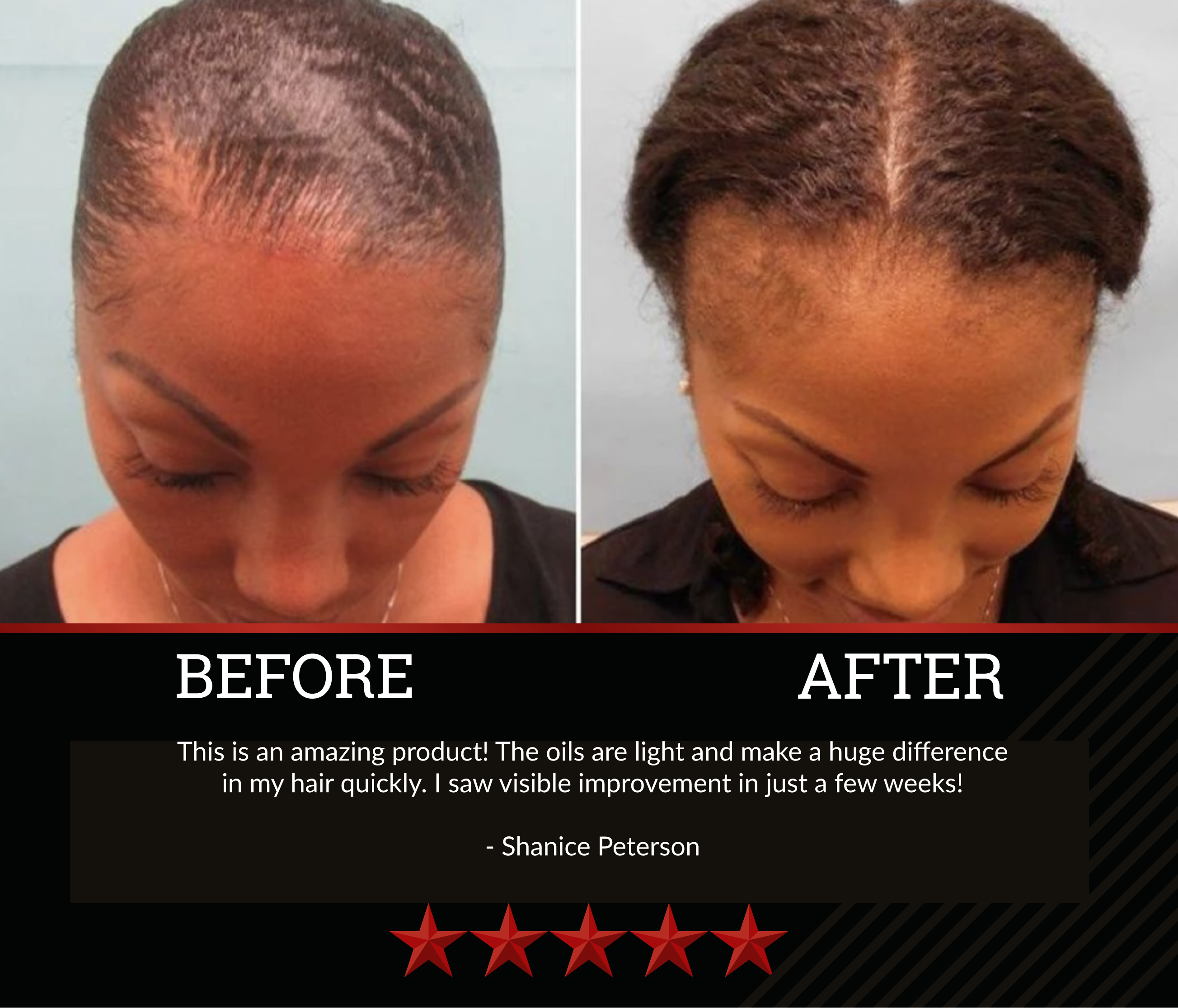The All-Natural Hair Growth Solution by Black Widow® (Buy More & Save)